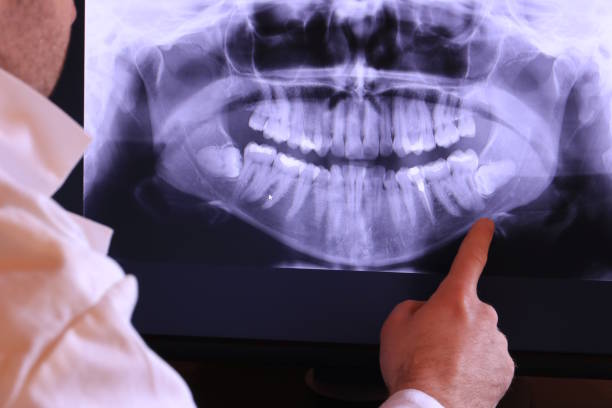 Best Emergency Dental Care for Broken or Chipped Teeth in Bayville, NY