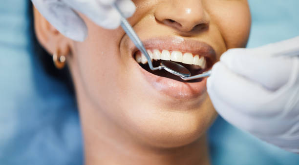 Best Emergency Treatment for Dental Infections or Abscesses in Bayville, NY