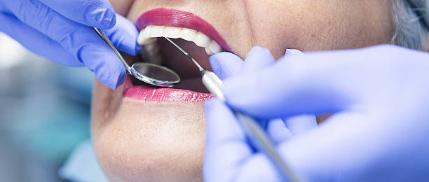Best Emergency Dental Care for Broken or Chipped Teeth in Bayville, NY